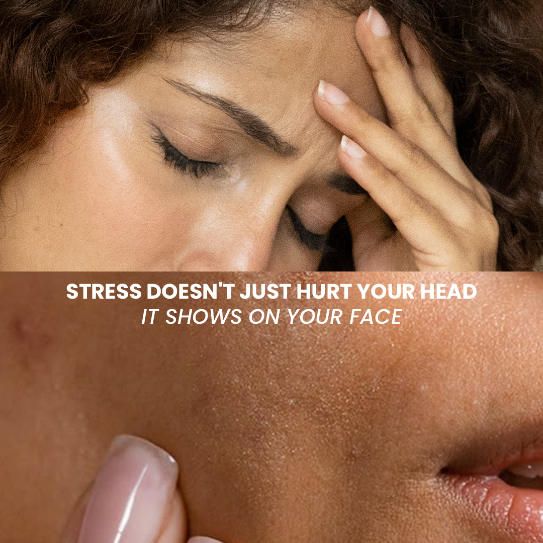 The Stress Head Kit